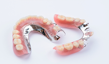 cast partial denture