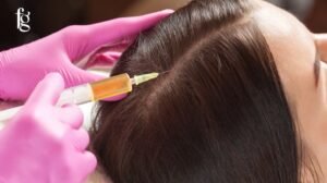 Read more about the article Restoration of Hair With Exosome Therapy in Karachi